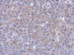 Syk Antibody in Immunohistochemistry (Paraffin) (IHC (P))