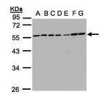 CaMKI gamma Antibody in Western Blot (WB)
