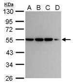 CaMKI gamma Antibody in Western Blot (WB)