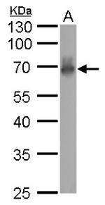 CaMKI gamma Antibody in Western Blot (WB)