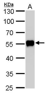 CaMKI gamma Antibody in Western Blot (WB)