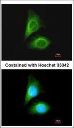 MST3 Polyclonal Antibody