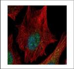 SPHK1 Polyclonal Antibody