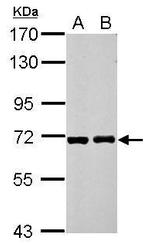 RIOK3 Antibody in Western Blot (WB)