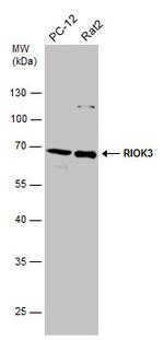 RIOK3 Antibody in Western Blot (WB)