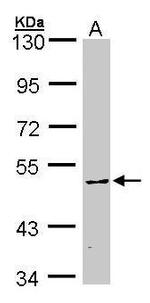 CaMKIV Polyclonal Antibody