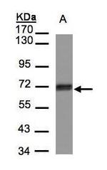 CCDC6 Antibody in Western Blot (WB)