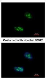 EXOSC10 Polyclonal Antibody