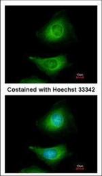 MEK3 Polyclonal Antibody