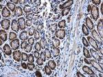 MEK3 Antibody in Immunohistochemistry (Paraffin) (IHC (P))