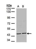 STK32B Antibody in Western Blot (WB)