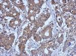 LYK5 Antibody in Immunohistochemistry (Paraffin) (IHC (P))