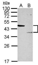 LYK5 Antibody in Western Blot (WB)