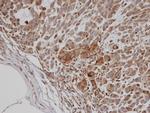 PFTK2 Antibody in Immunohistochemistry (Paraffin) (IHC (P))