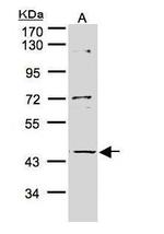 PFTK2 Antibody in Western Blot (WB)
