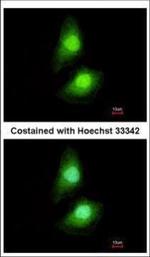 SKAP55 Polyclonal Antibody