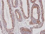 GK2 Polyclonal Antibody