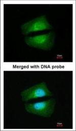 TAB1 Polyclonal Antibody