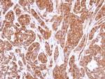 RIP3 Antibody in Immunohistochemistry (Paraffin) (IHC (P))