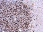 CK2 alpha-1 Polyclonal Antibody