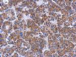 FN3K Polyclonal Antibody