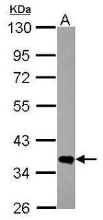 FN3K Antibody in Western Blot (WB)