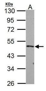 IKK gamma Antibody in Western Blot (WB)