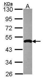 IKK gamma Antibody in Western Blot (WB)