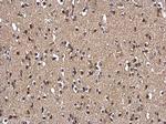 SEPHS1 Antibody in Immunohistochemistry (Paraffin) (IHC (P))