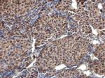 SEPHS1 Antibody in Immunohistochemistry (Paraffin) (IHC (P))