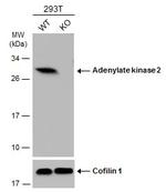 Adenylate Kinase 2 Antibody in Western Blot (WB)