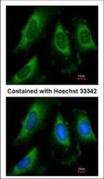 PGK1 Antibody in Immunocytochemistry (ICC/IF)