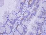 CoA Synthase Antibody in Immunohistochemistry (Paraffin) (IHC (P))