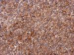PIP5KL1 Antibody in Immunohistochemistry (Paraffin) (IHC (P))