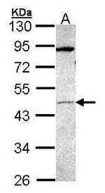 PRAK Polyclonal Antibody