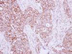 TBRG4 Antibody in Immunohistochemistry (Paraffin) (IHC (P))