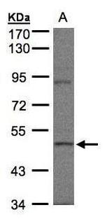 BRK Polyclonal Antibody