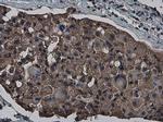 CrkL Antibody in Immunohistochemistry (Paraffin) (IHC (P))