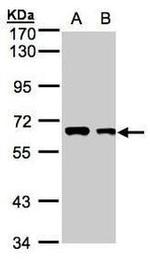 FGR Antibody in Western Blot (WB)