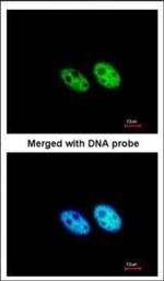 SART3 Antibody in Immunocytochemistry (ICC/IF)