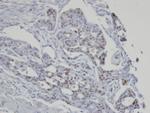 SART3 Antibody in Immunohistochemistry (Paraffin) (IHC (P))