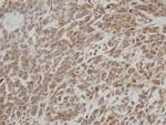 ALS2CR2 Antibody in Immunohistochemistry (Paraffin) (IHC (P))