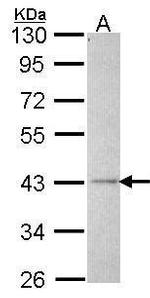 ALS2CR2 Antibody in Western Blot (WB)