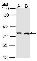 Rabenosyn 5 Polyclonal Antibody