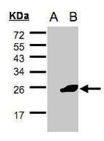 NCE2 Polyclonal Antibody