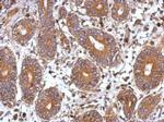 FHL2 Antibody in Immunohistochemistry (Paraffin) (IHC (P))