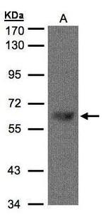 TBL1X Polyclonal Antibody
