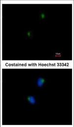 SLITRK1 Antibody in Immunocytochemistry (ICC/IF)