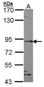 SLITRK1 Antibody in Western Blot (WB)