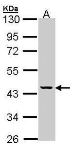 MVK Antibody in Western Blot (WB)